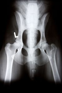 radiology01